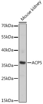 Western blot analysis of extracts of Mouse kidney using ACP5 Polyclonal Antibody at dilution of 1:1000.