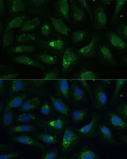 Immunofluorescence analysis of U-2 OS cells using AEBP1 Polyclonal Antibody at dilution of  1:100 (40x lens). Blue: DAPI for nuclear staining.