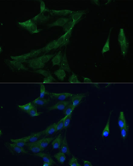 Immunofluorescence analysis of C6 cells using ARL3 Polyclonal Antibody at dilution of  1:100 (40x lens). Blue: DAPI for nuclear staining.