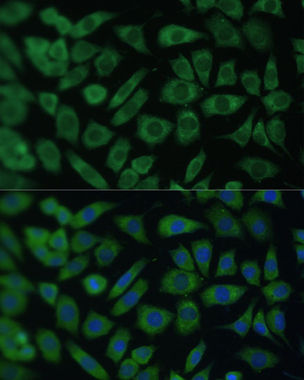 Immunofluorescence analysis of L929 cells using ARL3 Polyclonal Antibody at dilution of  1:100 (40x lens). Blue: DAPI for nuclear staining.