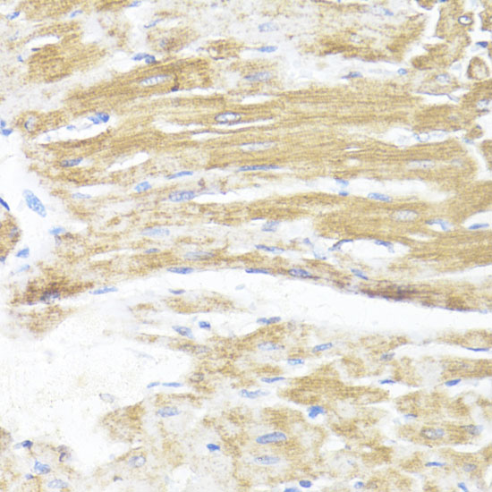 Immunohistochemistry of paraffin-embedded Rat heart using ASMT Polyclonal Antibody at dilution of  1:100 (40x lens).