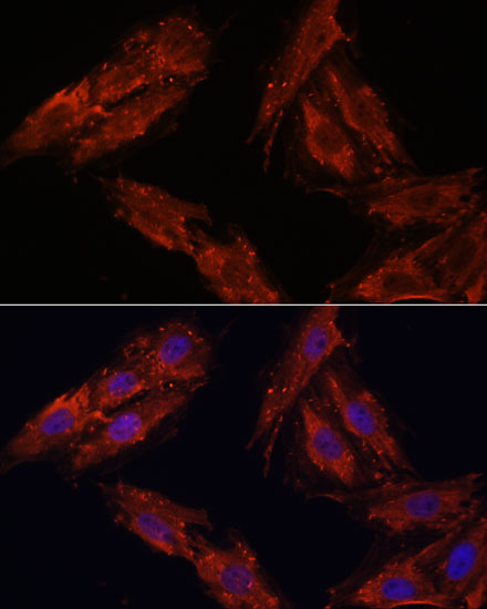 Immunofluorescence analysis of H9C2 cells using CDK6 Polyclonal Antibody at dilution of  1:100. Blue: DAPI for nuclear staining.