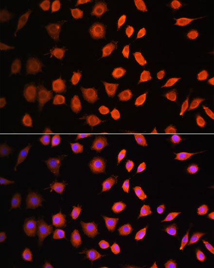 Immunofluorescence analysis of L929 cells using CDK6 Polyclonal Antibody at dilution of  1:100. Blue: DAPI for nuclear staining.