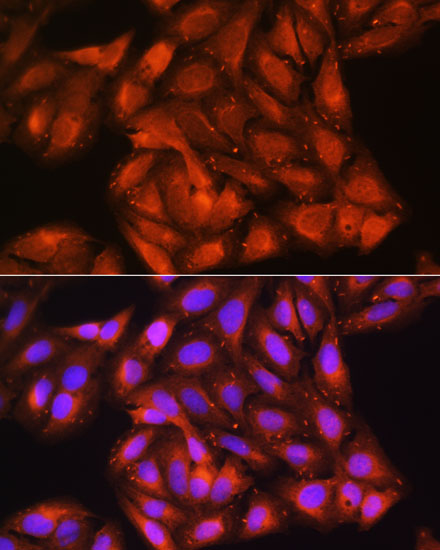 Immunofluorescence analysis of U-2 OS cells using CDK6 Polyclonal Antibody at dilution of  1:100. Blue: DAPI for nuclear staining.