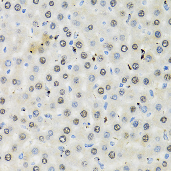 Immunohistochemistry of paraffin-embedded Rat liver using CDK6 Polyclonal Antibody at dilution of  1:100 (40x lens).