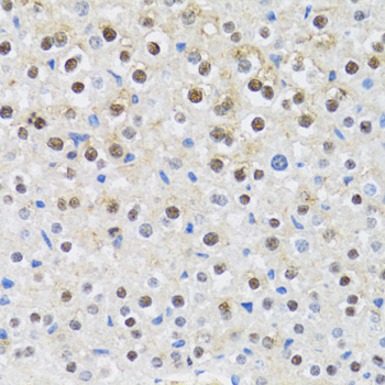Immunohistochemistry of paraffin-embedded Mouse liver using CDK6 Polyclonal Antibody at dilution of  1:100 (40x lens).