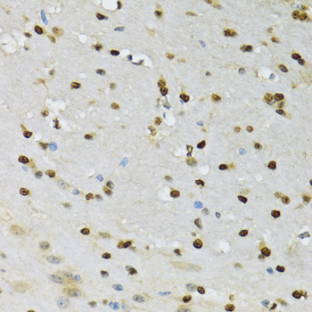 Immunohistochemistry of paraffin-embedded Mouse brain using CDK6 Polyclonal Antibody at dilution of  1:100 (40x lens).