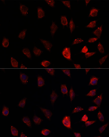 Immunofluorescence analysis of L929 cells using CYP11A1 Polyclonal Antibody at dilution of  1:100. Blue: DAPI for nuclear staining.