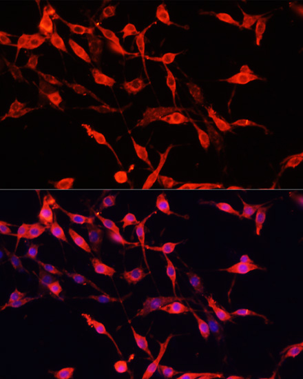 Immunofluorescence analysis of PC-12 cells using ENO3 Polyclonal Antibody at dilution of  1:100. Blue: DAPI for nuclear staining.