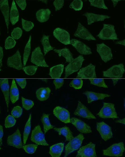 Immunofluorescence analysis of L929 cells using FKBP1B Polyclonal Antibody at dilution of  1:100 (40x lens). Blue: DAPI for nuclear staining.