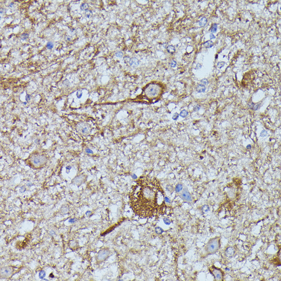 Immunohistochemistry of paraffin-embedded Mouse spinal cord using FKBP1B Polyclonal Antibody at dilution of  1:100 (40x lens).