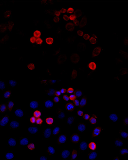 Immunofluorescence analysis of HeLa cells using FLNA Polyclonal Antibody at dilution of  1:100 (40x lens). Blue: DAPI for nuclear staining.