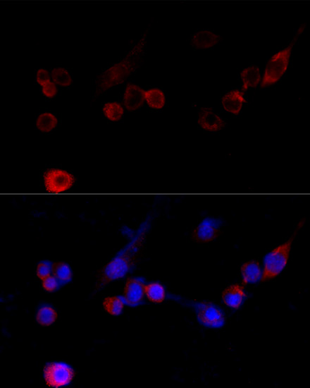 Immunofluorescence analysis of NIH/3T3 cells using FLNA Polyclonal Antibody at dilution of  1:100 (40x lens). Blue: DAPI for nuclear staining.