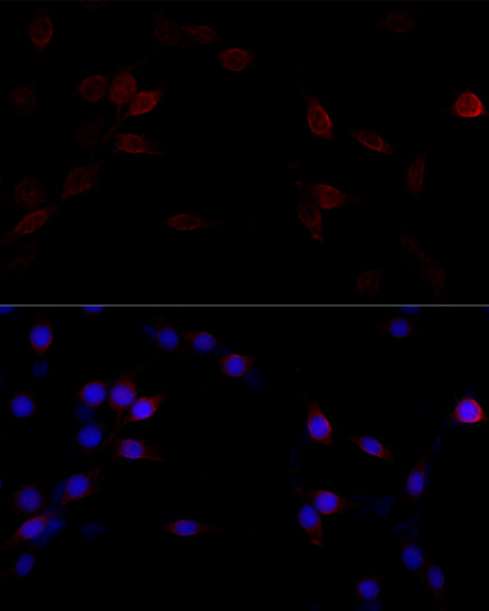 Immunofluorescence analysis of PC-12 cells using FLNA Polyclonal Antibody at dilution of  1:100 (40x lens). Blue: DAPI for nuclear staining.