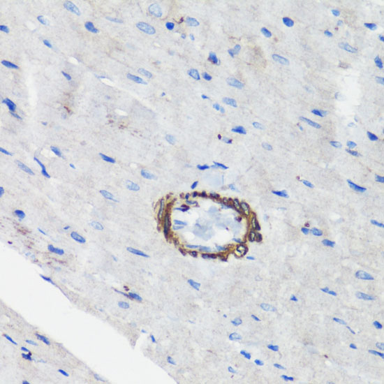 Immunohistochemistry of paraffin-embedded Rat heart using FLNA Polyclonal Antibody at dilution of  1:100 (40x lens).