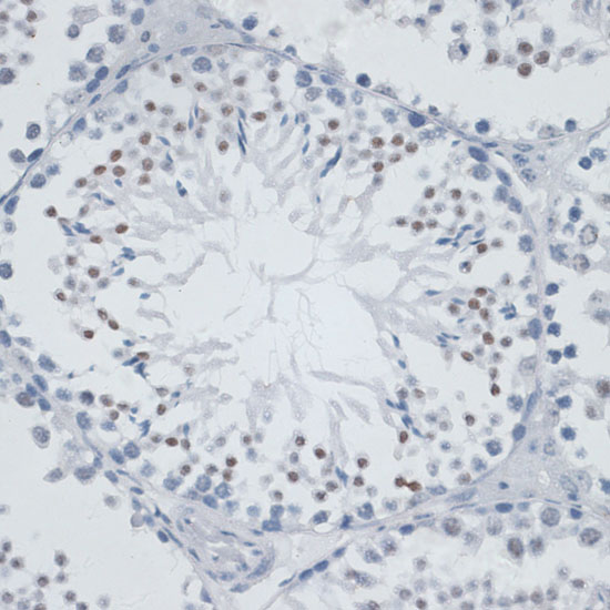 Immunohistochemistry of paraffin-embedded Mouse testis using MSH6 Polyclonal Antibody at dilution of  1:100 (40x lens).