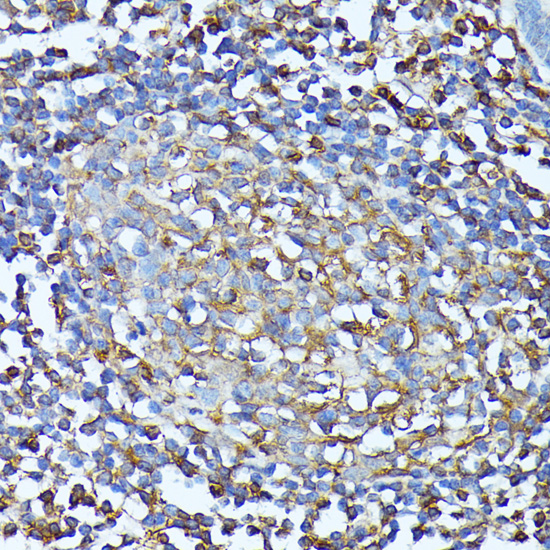 Immunohistochemistry of paraffin-embedded Human colon using CXCR1 Polyclonal Antibody at dilution of  1:100 (40x lens).