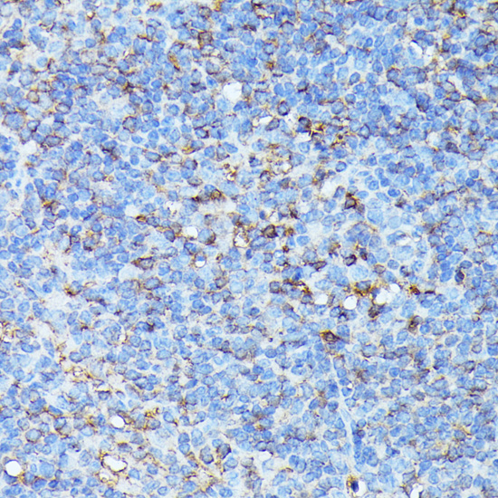 Immunohistochemistry of paraffin-embedded Mouse spleen using CXCR1 Polyclonal Antibody at dilution of  1:100 (40x lens).