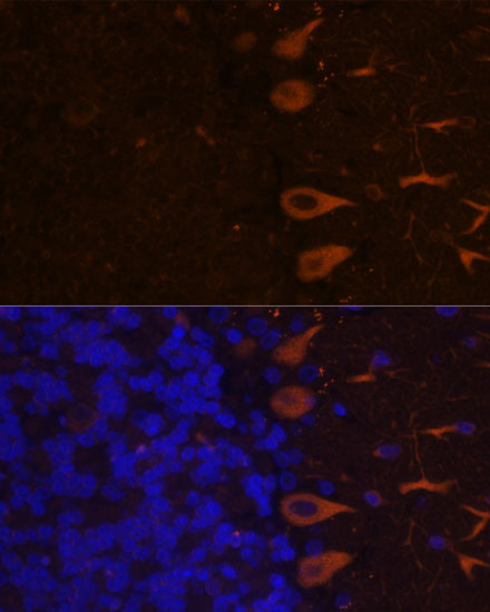 Immunofluorescence analysis of Rat brain using KAL1 Polyclonal Antibody at dilution of  1:100. Blue: DAPI for nuclear staining.