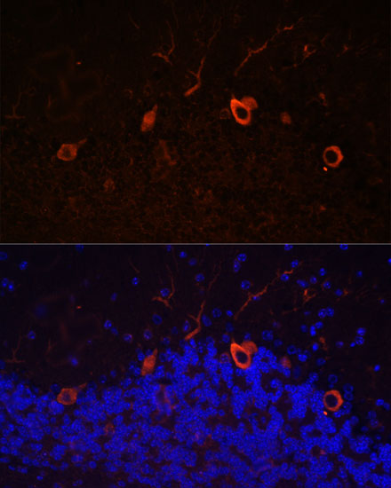 Immunofluorescence analysis of Mouse brain using KAL1 Polyclonal Antibody at dilution of  1:100. Blue: DAPI for nuclear staining.