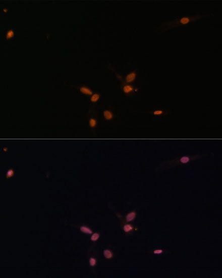 Immunofluorescence analysis of C6 cells using SMAD7 Polyclonal Antibody at dilution of  1:100. Blue: DAPI for nuclear staining.