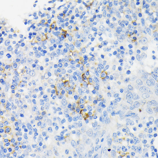 Immunohistochemistry of paraffin-embedded Human tonsil using CAMP Polyclonal Antibody at dilution of  1:200 (40x lens).