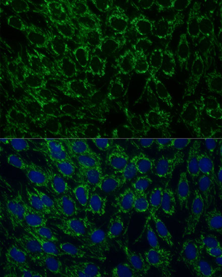 Immunofluorescence analysis of C6 cells using MTIF2 Polyclonal Antibody at dilution of  1:100 (40x lens). Blue: DAPI for nuclear staining.