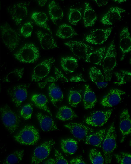 Immunofluorescence analysis of L929 cells using MTIF2 Polyclonal Antibody at dilution of  1:100 (40x lens). Blue: DAPI for nuclear staining.