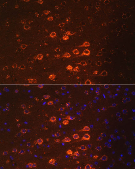 Immunofluorescence analysis of Mouse brain using NEFM Polyclonal Antibody at dilution of  1:100. Blue: DAPI for nuclear staining.