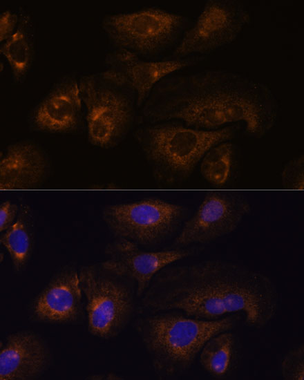 Immunofluorescence analysis of U-2 OS cells using PRSS8 Polyclonal Antibody at dilution of  1:100. Blue: DAPI for nuclear staining.