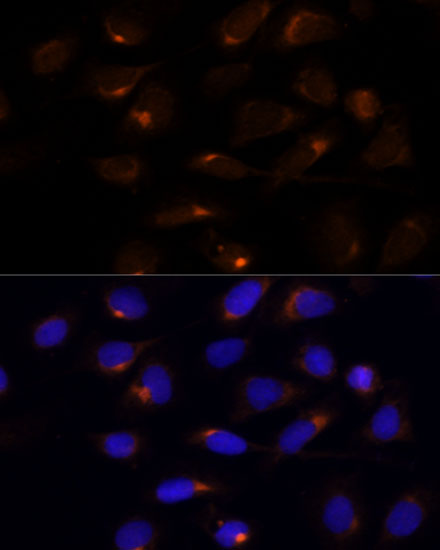 Immunofluorescence analysis of U-2 OS cells using SCD Polyclonal Antibody at dilution of  1:100 (40x lens). Blue: DAPI for nuclear staining.