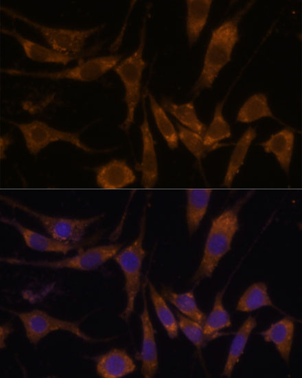 Immunofluorescence analysis of L929 cells using STAR Polyclonal Antibody at dilution of  1:100 (40x lens). Blue: DAPI for nuclear staining.