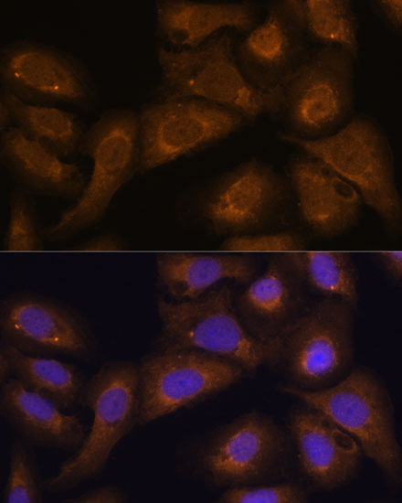 Immunofluorescence analysis of U-2 OS cells using STAR Polyclonal Antibody at dilution of  1:100 (40x lens). Blue: DAPI for nuclear staining.