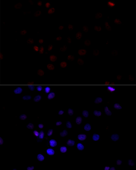 Immunofluorescence analysis of HeLa cells using TBP Polyclonal Antibody at dilution of  1:100 (40x lens). Blue: DAPI for nuclear staining.