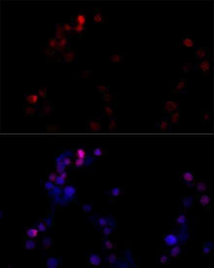 Immunofluorescence analysis of NIH/3T3 cells using TBP Polyclonal Antibody at dilution of  1:100 (40x lens). Blue: DAPI for nuclear staining.