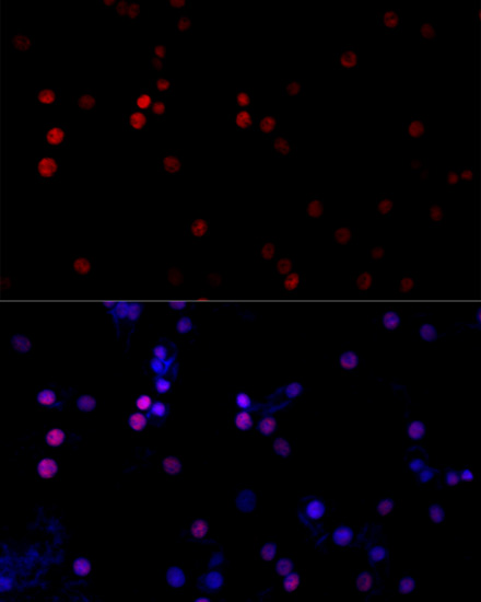 Immunofluorescence analysis of PC-12 cells using TBP Polyclonal Antibody at dilution of  1:100 (40x lens). Blue: DAPI for nuclear staining.