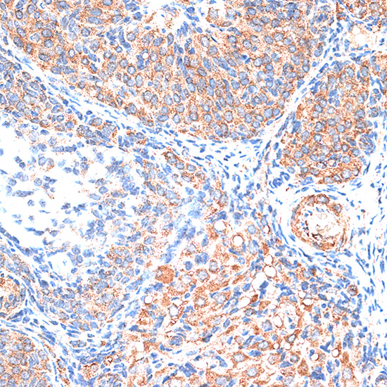 Immunohistochemistry of paraffin-embedded Rat ovary using TIMP2 Polyclonal Antibody at dilution of  1:100 (40x lens).