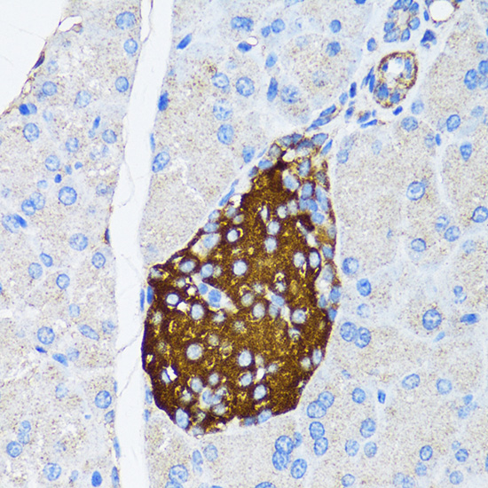Immunohistochemistry of paraffin-embedded Mouse pancreatic islet using TIMP2 Polyclonal Antibody at dilution of  1:150 (40x lens).