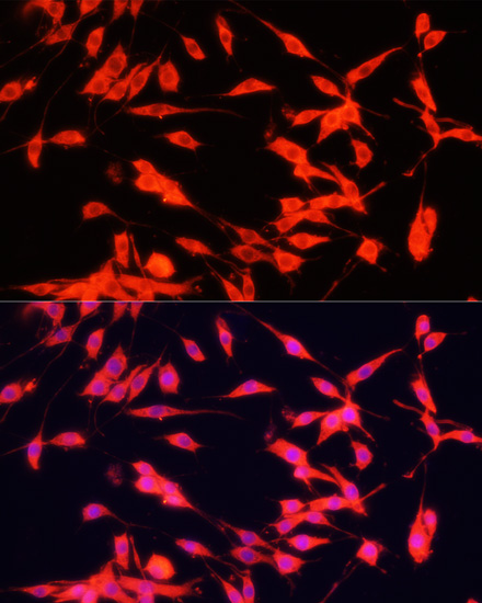 Immunofluorescence analysis of PC-12 cells using FXR1 Polyclonal Antibody at dilution of  1:100. Blue: DAPI for nuclear staining.