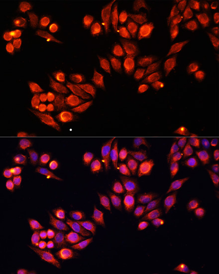 Immunofluorescence analysis of HeLa cells using Heparanase 1 Polyclonal Antibody at dilution of  1:100. Blue: DAPI for nuclear staining.