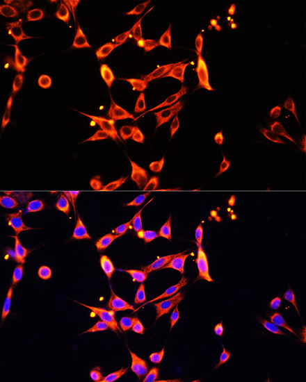 Immunofluorescence analysis of NIH/3T3 cells using Heparanase 1 Polyclonal Antibody at dilution of  1:100. Blue: DAPI for nuclear staining.