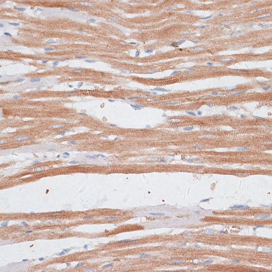 Immunohistochemistry of paraffin-embedded Rat heart using KATNA1 Polyclonal Antibody at dilution of  1:100 (40x lens).