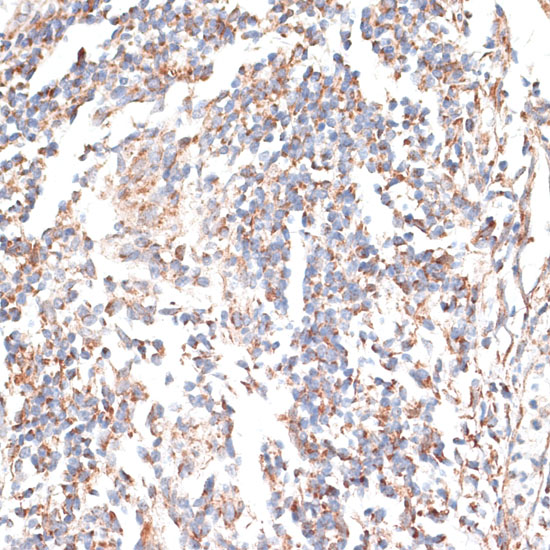 Immunohistochemistry of paraffin-embedded Human tonsil using KATNA1 Polyclonal Antibody at dilution of  1:100 (40x lens).