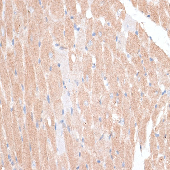 Immunohistochemistry of paraffin-embedded Mouse heart using KATNA1 Polyclonal Antibody at dilution of  1:100 (40x lens).