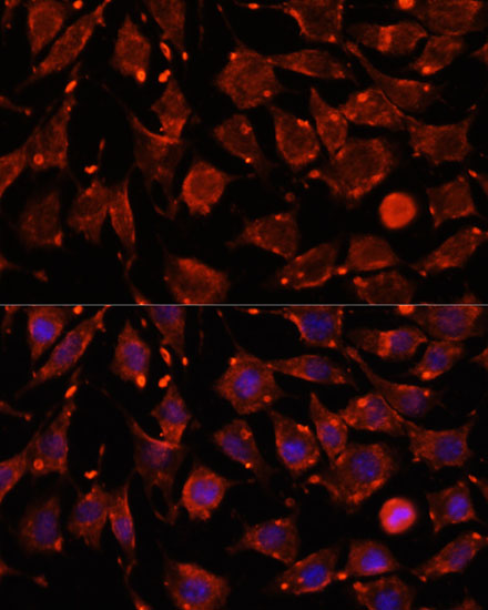 Immunofluorescence analysis of L929 cells using ITSN2 Polyclonal Antibody at dilution of  1:100. Blue: DAPI for nuclear staining.