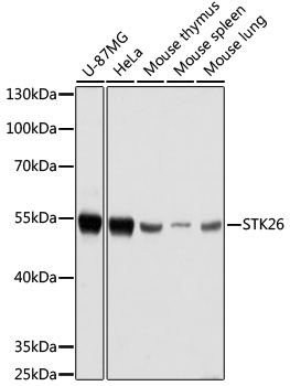 Western blot analysis of extracts of various cell lines using STK26 Polyclonal Antibody at dilution of 1:1000.