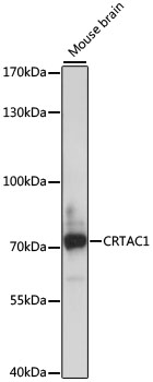 Western blot analysis of extracts of Mouse brain using CRTAC1 Polyclonal Antibody at dilution of 1:1000.