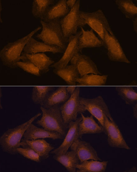 Immunofluorescence analysis of U-2 OS cells using SEPT3 Polyclonal Antibody at dilution of  1:100. Blue: DAPI for nuclear staining.