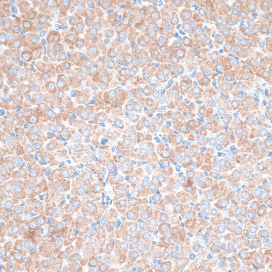 Immunohistochemistry of paraffin-embedded Rat ovary using PMEPA1 Polyclonal Antibody at dilution of  1:100 (40x lens).