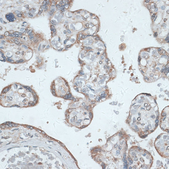 Immunohistochemistry of paraffin-embedded Human placenta using PMEPA1 Polyclonal Antibody at dilution of  1:100 (40x lens).